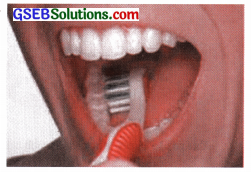 GSEB Solutions Class 9 English Chapter 2 Dental Health 5